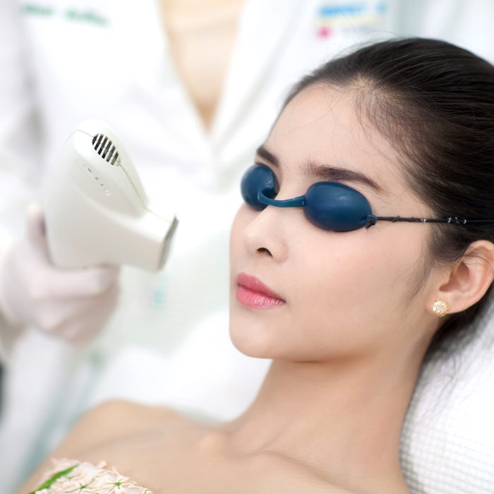 H80 Laser Pigmentation Facial Care